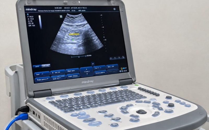 ultrassom-passa-a-ser-realizado-na-unidade-sanitaria-e-reduz-tempo-de-espera